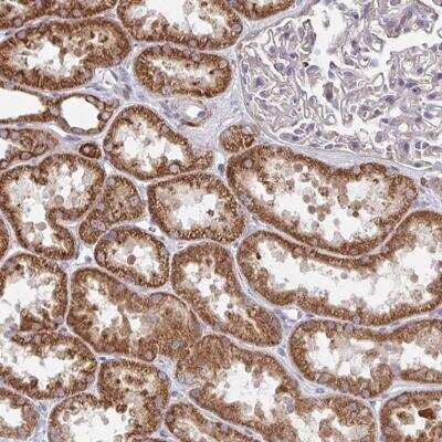 Immunohistochemistry-Paraffin: C20orf12 Antibody [NBP2-31772] - Staining of human kidney shows strong cytoplasmic positivity in cells in tubules.