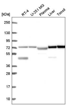Western Blot: C20orf12 Antibody [NBP2-57571] - Western blot analysis in human cell line RT-4, human cell line U-251 MG, human plasma, human liver tissue and human tonsil tissue.
