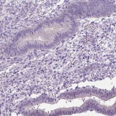 Immunohistochemistry-Paraffin: C20orf144 Antibody [NBP2-14398] - Staining of human endometrium shows low expression as expected.