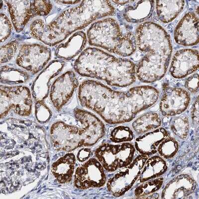 Immunohistochemistry-Paraffin: C20orf166 Antibody [NBP1-94083] - Staining of human kidney shows strong cytoplasmic positivity in cells in tubules.