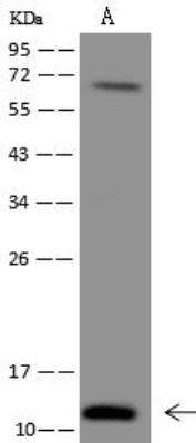 Western Blot: C20orf166 Antibody [NBP3-12639] - Lane A: Jurkat Whole Cell LysateLysates/proteins at 30 ug per lane.SecondaryGoat Anti-Rabbit IgG (H+L)/HRP at 1/10000 dilution.Developed using the ECL technique.Performed under reducing conditions.Predicted band size:12 kDaObserved band size:12 kDa(We are unsure as to the identity of these extra bands.)