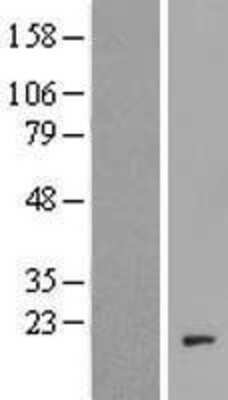 Western Blot: C20orf166 Overexpression Lysate (Adult Normal) [NBP2-04965] Left-Empty vector transfected control cell lysate (HEK293 cell lysate); Right -Over-expression Lysate for C20orf166.