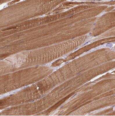 Immunohistochemistry FAM65C Antibody - BSA Free