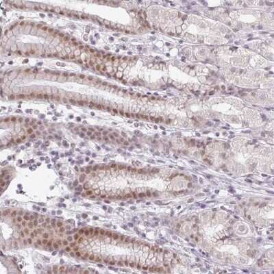 Immunohistochemistry-Paraffin: C20orf175 Antibody [NBP2-30556] - Staining of human stomach, lower shows moderate nuclear positivity in glandular cells.