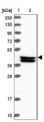 Western Blot: C20orf177 Antibody [NBP1-94080] - Lane 1: Marker  [kDa] 250, 130, 95, 72, 55, 36, 28, 17, 10.  Lane 2: Human cell line RT-4