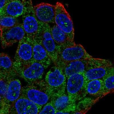 Immunocytochemistry/ Immunofluorescence C20orf194 Antibody