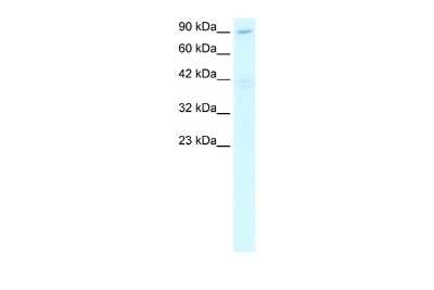 Western Blot: C20orf194 Antibody [NBP2-84550] - WB Suggested Anti-C20ORF194 Antibody Titration: 2.5ug/ml. ELISA Titer: 1:312500. Positive Control: Human heart