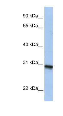 Western Blot: C20orf195 Antibody [NBP1-57700] - MCF-7 whole cell lysates, concentration 0.2-1 ug/ml.