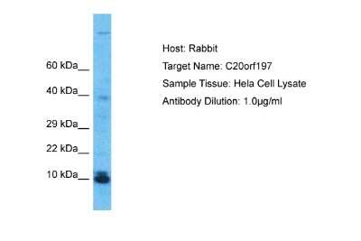 Western Blot: C20orf197 Antibody [NBP2-82878] - Host: Rabbit. Target Name: C20orf197. Sample Type: Hela Whole Cell lysates. Antibody Dilution: 1.0ug/ml