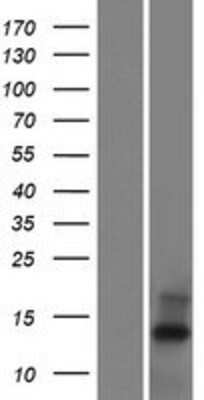 Western Blot C20orf202 Overexpression Lysate