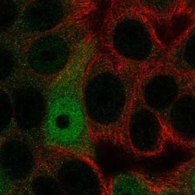 Immunocytochemistry/Immunofluorescence: C20orf29 Antibody [NBP2-68652] - Staining of human cell line MCF7 shows localization to nucleoplasm & cytosol.