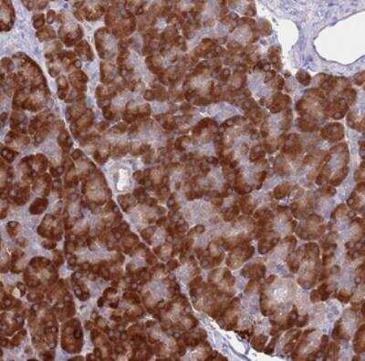 Immunohistochemistry: C20orf29 Antibody [NBP2-30509] - Staining of human pancreas shows strong cytoplasmic positivity in exocrine glandular cells.