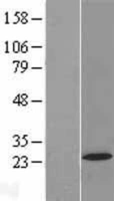 Western Blot: C20orf29 Overexpression Lysate (Adult Normal) [NBL1-08370] Left-Empty vector transfected control cell lysate (HEK293 cell lysate); Right -Over-expression Lysate for C20orf29.