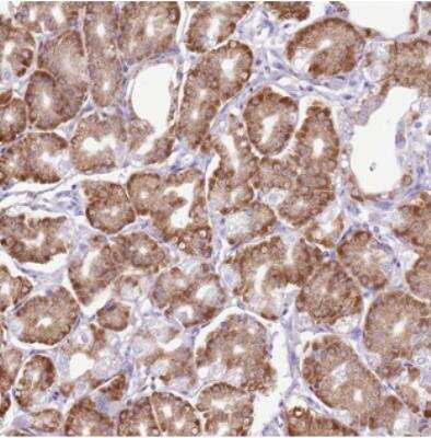 Immunohistochemistry-Paraffin: AAR2 Antibody [NBP2-30422] - Staining of human stomach, lower shows strong cytoplasmic positivity in glandular cells.
