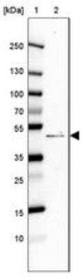 Western Blot AAR2 Antibody - BSA Free