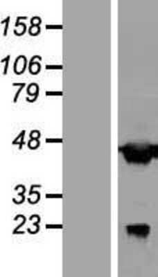 Western Blot: AAR2 Overexpression Lysate [NBL1-08374] - Left-Empty vector transfected control cell lysate (HEK293 cell lysate); Right -Over-expression Lysate for C20orf4.