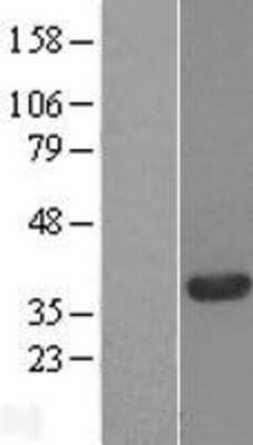 Western Blot: C20orf43 Overexpression Lysate (Adult Normal) [NBL1-08375] Left-Empty vector transfected control cell lysate (HEK293 cell lysate); Right -Over-expression Lysate for C20orf43.