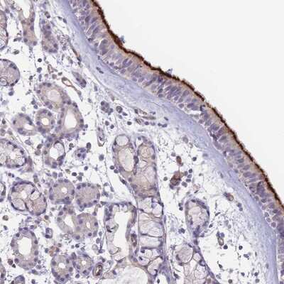 Immunohistochemistry-Paraffin: C20orf7 Antibody [NBP2-14400] Staining of human nasopharynx shows strong membranous positivity in respiratory epithelial cells.