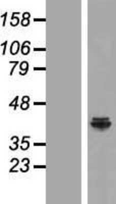 Western Blot NDUFAF5 Overexpression Lysate