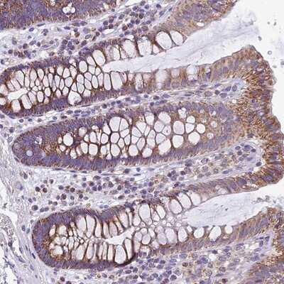 Immunohistochemistry-Paraffin: C20orf72 Antibody [NBP1-91726] - Staining of human colon shows strong cytoplasmic positivity in glandular cells.