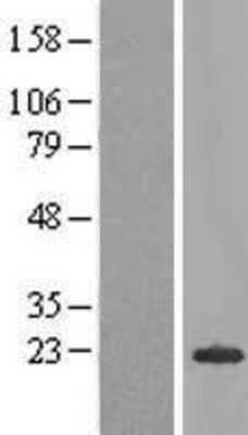 Western Blot: C20orf79 Overexpression Lysate (Adult Normal) [NBL1-08381] Left-Empty vector transfected control cell lysate (HEK293 cell lysate); Right -Over-expression Lysate for C20orf79.