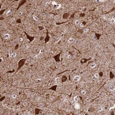 Immunohistochemistry-Paraffin: C20orf94 Antibody [NBP2-14567] - Staining of human cerebral cortex shows  strong cytoplasmic positivity in neurons.