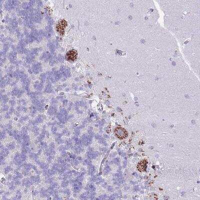 Immunohistochemistry-Paraffin: C20orf96 Antibody [NBP2-14649] - Staining of human cerebellum shows strong cytoplasmic positivity in granular pattern in Purkinje cells.