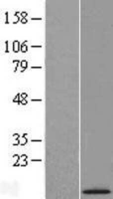 Western Blot: C21orf119 Overexpression Lysate (Adult Normal) [NBL1-08383] Left-Empty vector transfected control cell lysate (HEK293 cell lysate); Right -Over-expression Lysate for C21orf119.