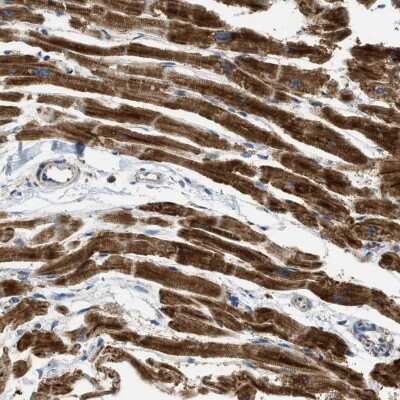 Immunohistochemistry: C21orf33 Antibody [NBP2-47532] - Staining of heart muscle tissue. Shows strong cytoplasmic positivity in myocytes.