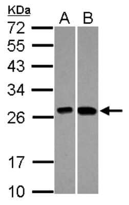 Western Blot: C21orf33 Antibody [NBP2-15645] - Sample (30 ug of whole cell lysate) A: A549 B: HepG2 12% SDS PAGE gel, diluted at 1:1000.