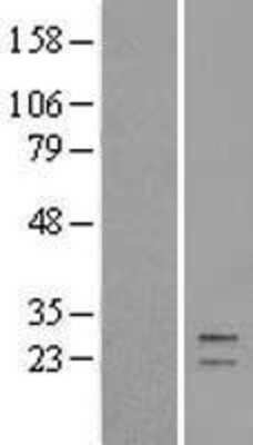 Western Blot: C21orf33 Overexpression Lysate (Adult Normal) [NBL1-08385] Left-Empty vector transfected control cell lysate (HEK293 cell lysate); Right -Over-expression Lysate for C21orf33.