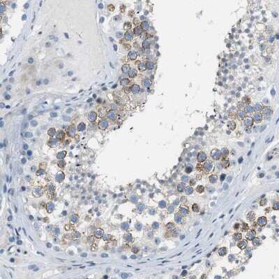Immunohistochemistry-Paraffin SPATC1L Antibody - BSA Free