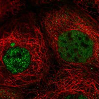 Immunocytochemistry/Immunofluorescence: C21orf58 Antibody [NBP2-47531] - Immunofluorescent staining of human cell line A-431 shows localization to nucleoplasm.