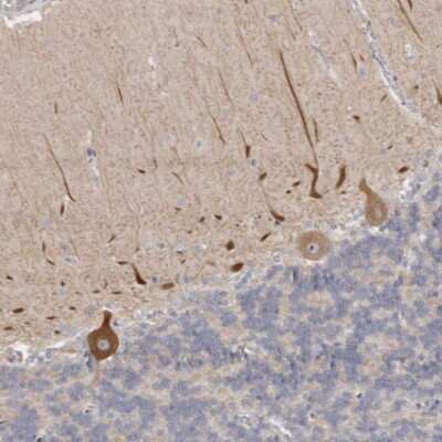 Immunohistochemistry-Paraffin: C21orf59 Antibody [NBP1-88275] - Staining of human cerebellum shows cytoplasmic immunoreactivity in Purkinje cells.