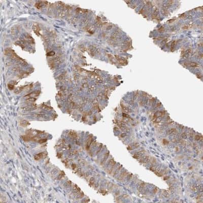 Immunohistochemistry-Paraffin: C21orf59 Antibody [NBP1-88275] - Staining of human fallopian tube shows strong positivity in a subset of glandular cells.