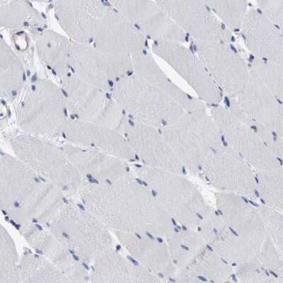 Immunohistochemistry-Paraffin: C21orf59 Antibody [NBP1-88277] - Staining of human skeletal muscle shows low expression as expected.