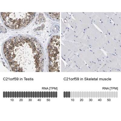Immunohistochemistry-Paraffin: C21orf59 Antibody [NBP1-88277] - Staining in human testis and skeletal muscle tissues using anti-C21orf59 antibody. Corresponding C21orf59 RNA-seq data are presented for the same tissues.