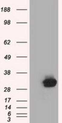 Western Blot: C21orf59 Antibody (OTI2H5) - Azide and BSA Free [NBP2-72060] - HEK293T cells were transfected with the pCMV6-ENTRY control (Left lane) or pCMV6-ENTRY C21orf59 (Right lane) cDNA for 48 hrs and lysed. Equivalent amounts of cell lysates (5 ug per lane) were separated by SDS-PAGE and immunoblotted with anti-C21orf59.