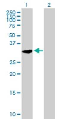 Western Blot: C21orf59 Antibody [H00056683-B01P] - Analysis of C21orf59 expression in transfected 293T cell line by C21orf59 polyclonal antibody.  Lane 1: C21orf59 transfected lysate(31.9 KDa). Lane 2: Non-transfected lysate.