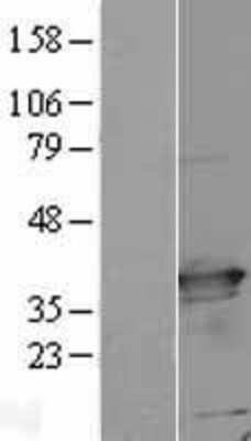 Western Blot: C21orf59 Overexpression Lysate (Adult Normal) [NBL1-08388] Left-Empty vector transfected control cell lysate (HEK293 cell lysate); Right -Over-expression Lysate for C21orf59.