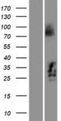 Western Blot: C21orf62 Overexpression Lysate (Adult Normal) [NBL1-08389] Left-Empty vector transfected control cell lysate (HEK293 cell lysate); Right -Over-expression Lysate for C21orf62.