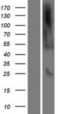 Western Blot: C21orf62 Overexpression Lysate (Adult Normal) [NBP2-10182] Left-Empty vector transfected control cell lysate (HEK293 cell lysate); Right -Over-expression Lysate for C21orf62.