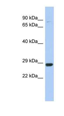 Western Blot: C21orf91 Antibody [NBP1-56533] - THP-1 cell lysate, concentration 0.2-1 ug/ml.
