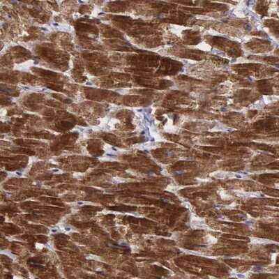 Immunohistochemistry-Paraffin: C22orf29 Antibody [NBP1-93956] - Staining of human heart muscle shows strong cytoplasmic positivity in myocytes.