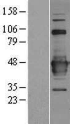 Western Blot: C22orf29 Overexpression Lysate (Adult Normal) [NBP2-06292] Left-Empty vector transfected control cell lysate (HEK293 cell lysate); Right -Over-expression Lysate for C22orf29.