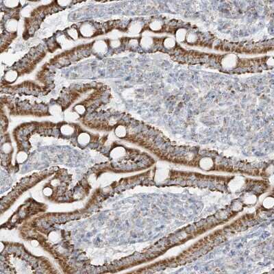 Immunohistochemistry-Paraffin: SMDT1 Antibody [NBP1-84289] -  Staining of human duodenum shows moderate granular cytoplasmic positivity in glandular cells.
