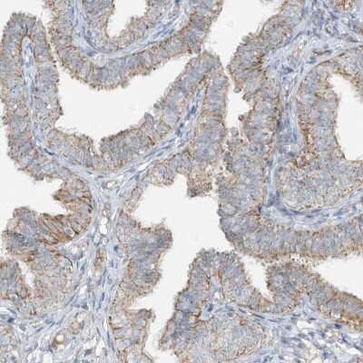 Immunohistochemistry-Paraffin: SMDT1 Antibody [NBP1-84289] -  Staining of human fallopian tube shows moderate granular cytoplasmic positivity in glandular cells.