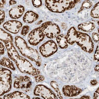 Immunohistochemistry-Paraffin: SMDT1 Antibody [NBP1-84289] -  Staining of human kidney shows strong granular cytoplasmic positivity in cells in tubules.