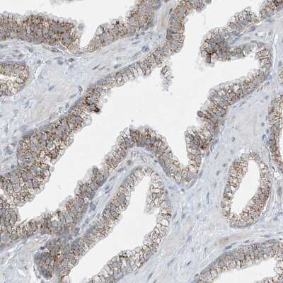Immunohistochemistry-Paraffin: SMDT1 Antibody [NBP1-84289] - Staining of human prostate shows moderate granular cytoplasmic positivity in glandular cells.