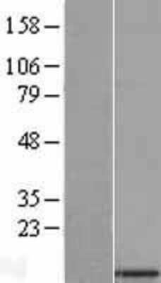 Western Blot SMDT1 Overexpression Lysate